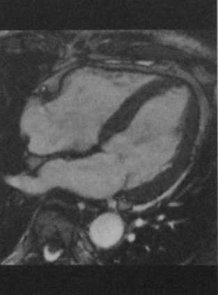 Снимки МРТ и КТ. Артериальная гипертензия