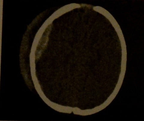 Снимки МРТ и КТ. Черепно-мозговая травма у детей