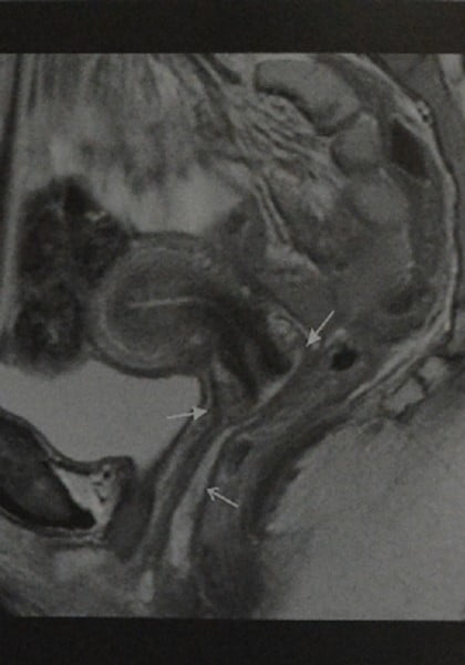 Снимки МРТ и КТ. Анатомия матки и влагалища