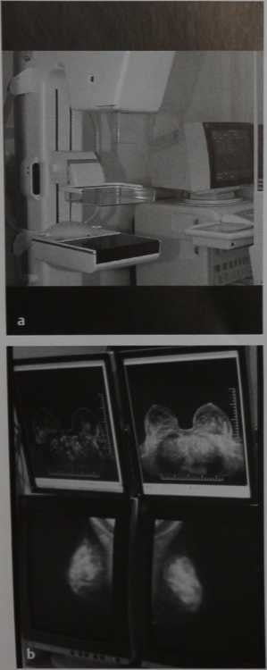 Снимки МРТ и КТ. Маммография: цифровая маммография